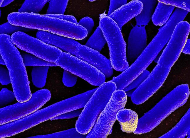 E. coli provoque le plus souvent le développement de cystites chez les femmes.
